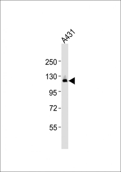 ZFYVE20 Antibody (N-Term)