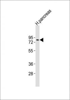 SPHK2 Antibody (N-term)