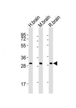 KCNMB2 Antibody (C-term)