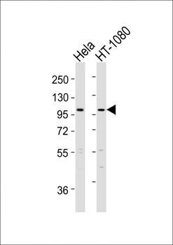 ADAMTS6 Antibody (N-Term)