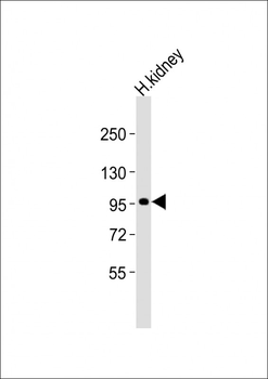 ADAMTS6 Antibody (N-Term)