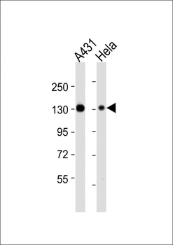 ITGA3 Antibody (N-term)