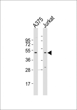 CCR1 Antibody (N-term)