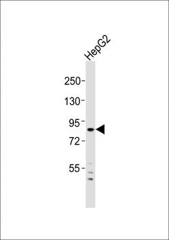 ADAM15 Antibody (N-Term)