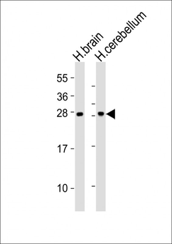 CNTF Antibody (C-term)