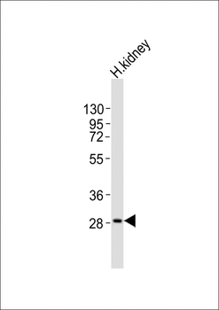PPAP2A Antibody (C-term)