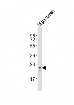 Mouse Mesp1 Antibody (Center)