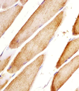 Htr2a Antibody (N-term)