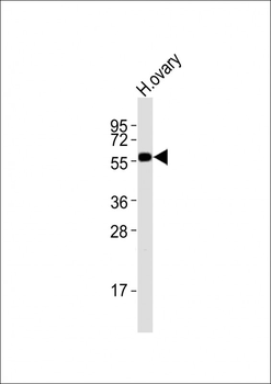 DRD5 Antibody (C-term)