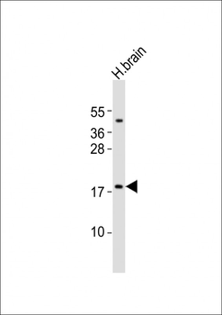 CALY Antibody (N-term)