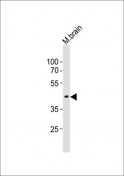 EED Antibody (N-term)