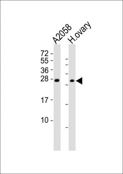RHOXF1 Antibody (Center)