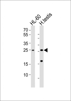 RHOXF1 Antibody (Center)