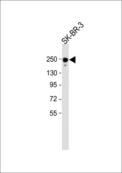 Erbb2 Antibody (P1236)