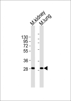 Mouse Hoxb4 Antibody (C-term)