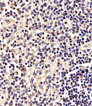 STAT5A Antibody (C-term)