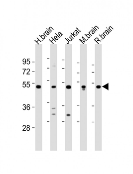CHST1 Antibody (C-term)