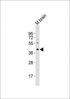 Mouse Rad9a Antibody (N-term)