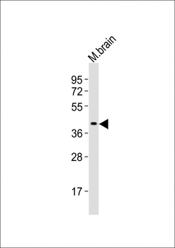 Mouse Rad9a Antibody (N-term)