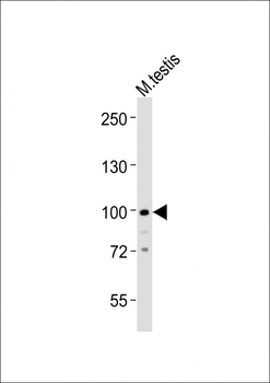 (Mouse) Med15 Antibody (C-term)