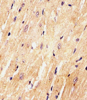 (Mouse) Med15 Antibody (C-term)