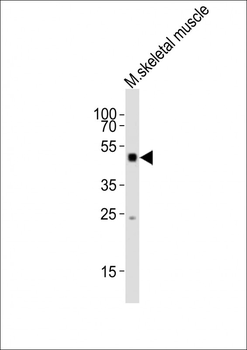 (Mouse) Smad1 Antibody (Center)