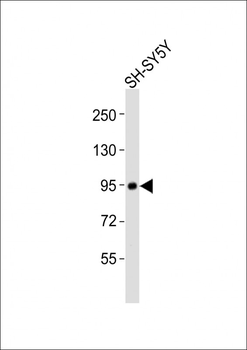 PROX1 Antibody (Center)