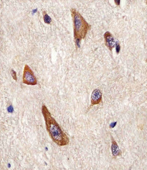 LRRK2 Antibody (C-term)