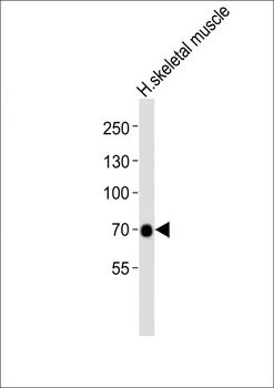 GABRQ Antibody (C-term)