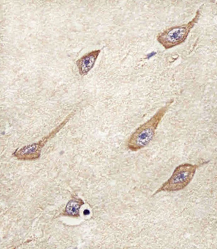 FAM168B Antibody (Center)