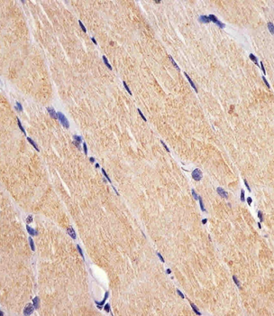 FES Antibody
