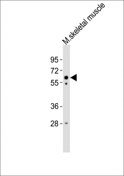 (Mouse) Smarcd3 Antibody (Center)