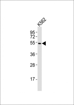 (Mouse) Smarcd3 Antibody (Center)