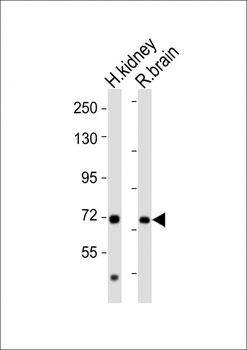 AACS Antibody (C-term)