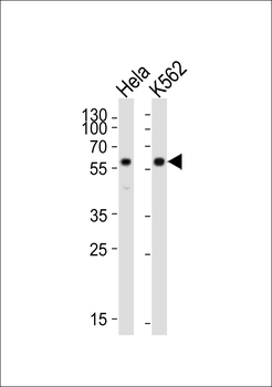 Mouse Cdk8 Antibody (C-term)