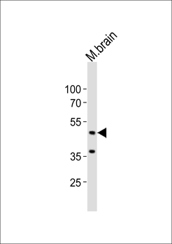 (Mouse) Eed Antibody (N-term)