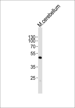 Mouse Pax6 Antibody (C-term)