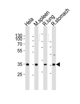 (RAT) Ccnd3 Antibody (N-term)