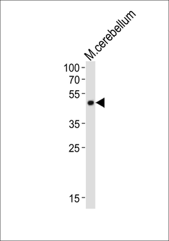 Mouse Pax6 Antibody (C-term)
