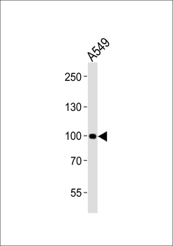 CHSY3 Antibody (Center)