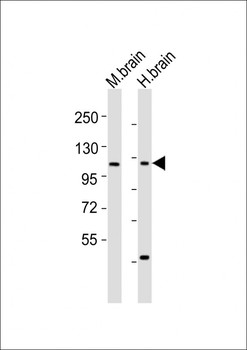 CHSY3 Antibody (Center)