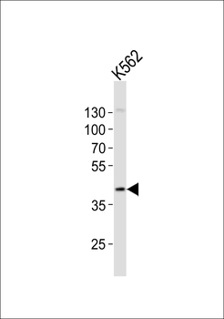 CHST11 Antibody (Center)