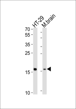 TMEM160 Antibody (N-term)