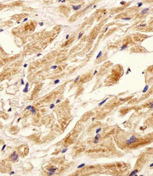 ITGB8 Antibody (Center)