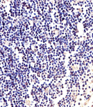 ANAPC2 Antibody (C-term)