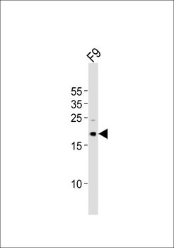 (Mouse) Tdgf1 Antibody (N-term)