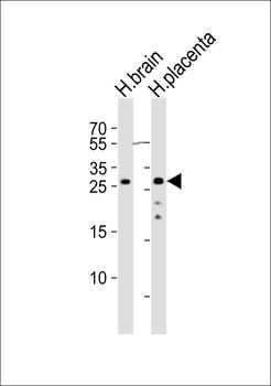 CHMP4A Antibody (C-term)