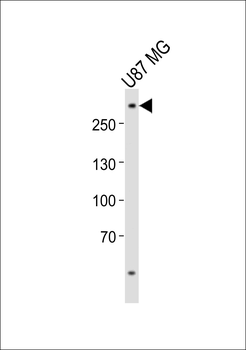 ABCA2 Antibody (Center)