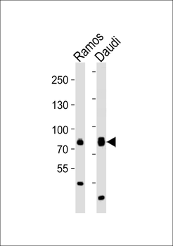 TEC Antibody (Center)