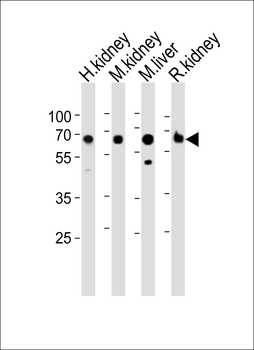ACSM5 Antibody (C-term)
